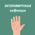 Об энтеровирусной инфекции на 30 неделе